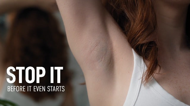 Certain Dri Prescription Strength Clinical Antiperspirant Roll-On Deodorant, Hyperhidrosis Treatment for Men & Women, Unscented, 1.2 Fl oz, 1 Pack