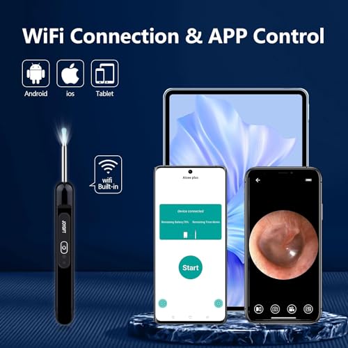 Ear Wax Removal Camera,Newly Upgraded 1080P Earpick,with IP67 Waterproof Lens,6 LED Lights,8Pcs Ear Care Kit for Daily Use,Wireless Visual Ear Scoop Tool for Android and iPhone Tablets,Black
