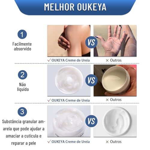 Urea Cream 40 Percent, Urea Foot & Hand Cream for Dry Cracked, 40 per Urea Lotion for Feet Maximum Strength