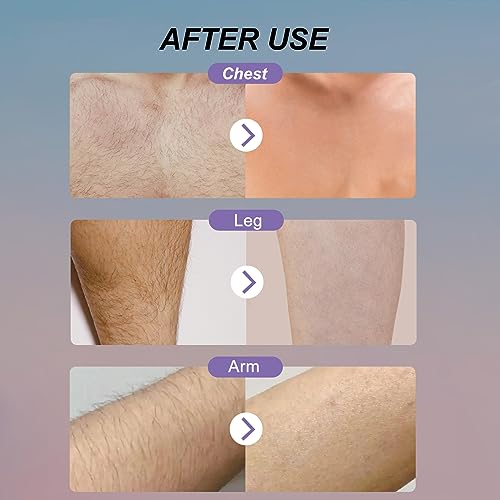 Crystal Hair Eraser, Reusable Hair Removal Pattern Design Painless Exfoliation Hair Removal Device, Portable Magic Hair Eraser for Back Arms Legs, Women and Men (Bright Blue)