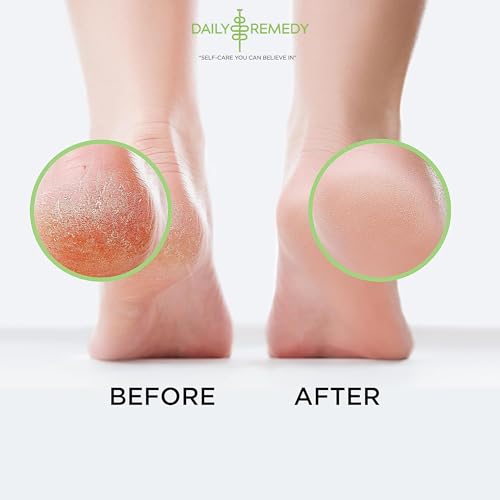 Tea Tree Oil Foot Soak with Epsom Salt - Made in USA - for Toenail Athletes Foot, Stubborn Foot Odor Scent, Softens Calluses & Soothes Sore Tired Feet - 16 Ounces