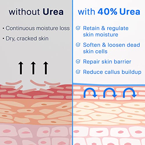 Ebanel Urea Cream 40% plus Salicylic Acid 2%, Foot Cream for Dry Cracked Heels Feet Knees Elbows Hands, Foot Dead Skin Cuticle Callus Remover Toenail Softener, Keratolytic Skin Barrier Repair Cream