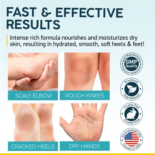 NUVADERMIS Urea Cream 40 Percent for Feet - 40% Urea Foot Repair Lotion - Maximum Strength For Dry Cracked Heels - 2% Salicylic Acid, Shea Butter, Tea Tree Oil, Vitamin E - 5.29 oz Jar