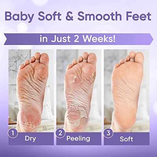 Foot Peel Mask (2 Pairs) - for Baby Soft Skin Remove Dead Skin, Dry, Cracked Feet & Callus, Spa, Made with Aloe Vera Extract Women and Men Peeling Exfoliating, Lavender