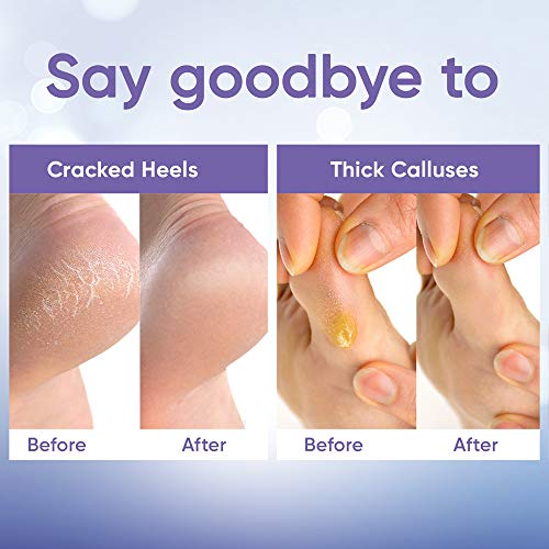 Foot Peel Mask (2 Pairs) - for Baby Soft Skin Remove Dead Skin, Dry, Cracked Feet & Callus, Spa, Made with Aloe Vera Extract Women and Men Peeling Exfoliating, Lavender