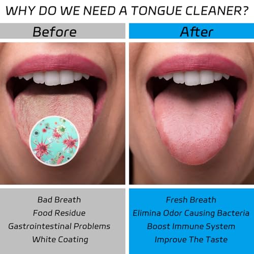 Tongue Scraper for Adults, 2 Pack Stainless Steel Tongue Cleaner, Surgical Grade Metal Fresh Breath Tongue Brush Kits with Travel Case for Men & Women Oral Care Bad Breath Cure (Gold)