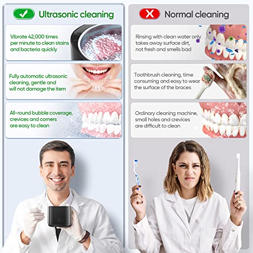 Ultrasonic Cleaner for Dentures, Odotoino 25W Professional Ultrasonic Cleaner Machine for all Dental, Retainer, Aligner, Braces, Mouth Guards, Toothbrush Head, Shaver Head, Jewelry, Black